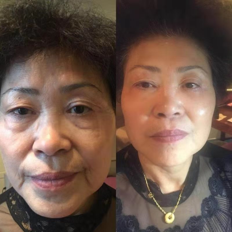 【限时秒杀】OUSIBEIYU欧思贝语永久花奢养肤油（立减100元）