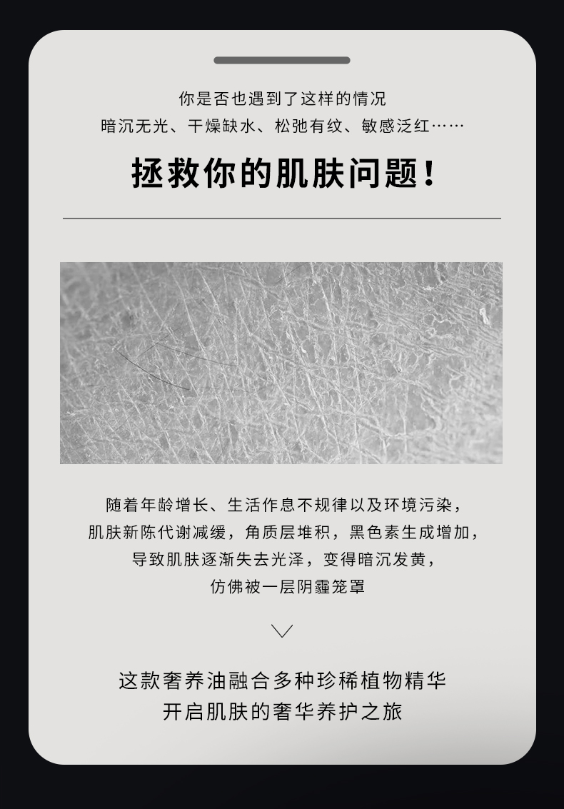 【限时秒杀】OUSIBEIYU欧思贝语永久花奢养肤油（立减100元）