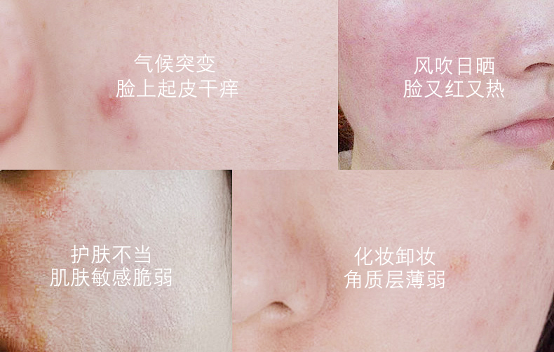 【限时优惠】银城木槿清润舒缓精华露40g|舒缓肌肤不红脸|持水滋润真莹润|稳固屏障强耐受