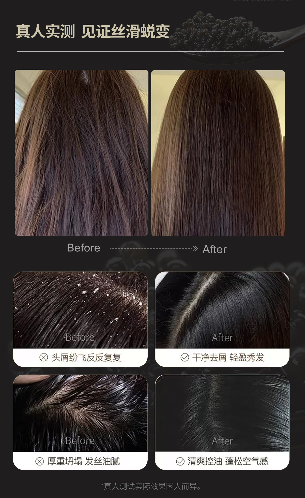 【兰蔻AKQ】葡萄糖多维赋活头皮洗发水500ml+莫奈花园香水沐浴露500ml（组合装）