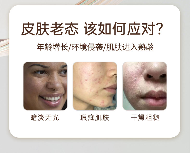 【兰寇AKQ】光感奢养紧致抗皱贵妇膏（全新升级）   全肤质通用，尤其是脆弱肌  50g/瓶