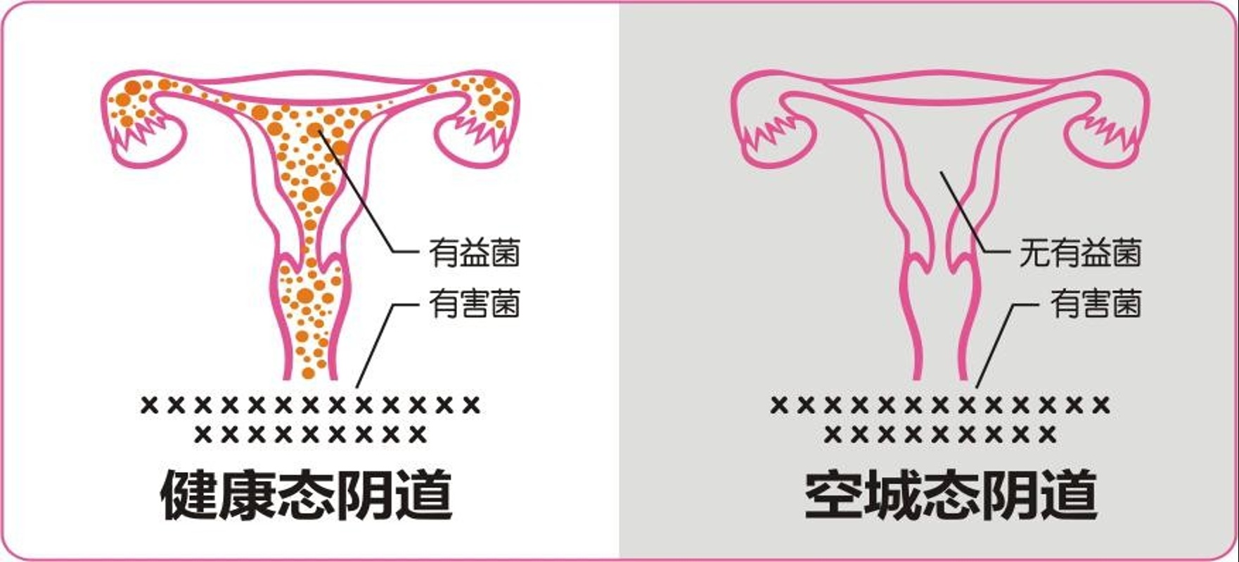 【私恩】茹处®乳酸抑菌片 规格：0.8克/片×8片 （私护专用）
