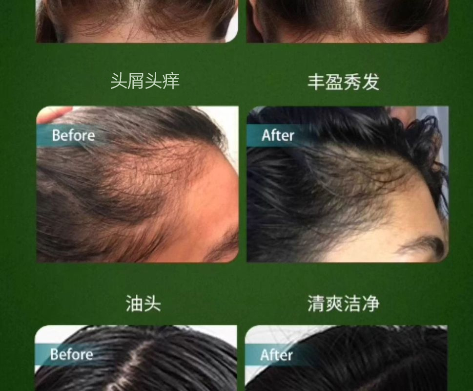 【印度进口】人参洗发水